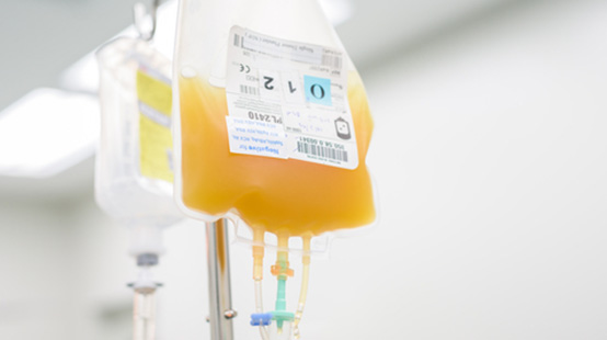Straw colored Intravenous bag filled with blood plasma.